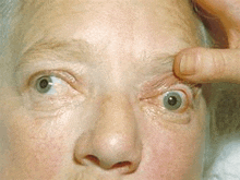 a close up of an elderly woman 's eye with a person 's hand on it .