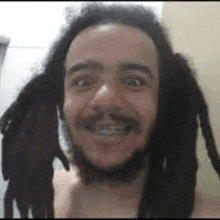 a man with dreadlocks and braces is smiling .