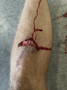 a close up of a person 's leg with blood coming out of the wound