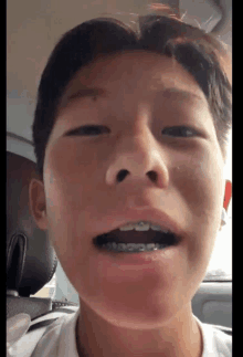 a boy with braces on his teeth is making a funny face