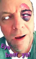 a man with a black eye has the words " eye hear ya " on the bottom