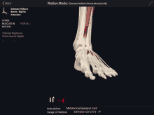 a computer screen shows a skeleton of a foot and says motion mode at the top