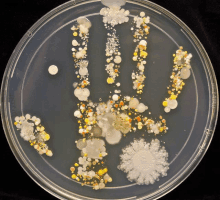 a petri dish with a hand made of bacteria