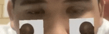 a close up of a person 's face with a picture of a person 's eyes on it .