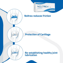 a box that says noltrex reduces friction and protection of cartilage