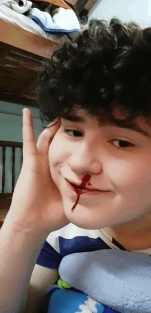 a boy with a bloody nose is smiling for the camera