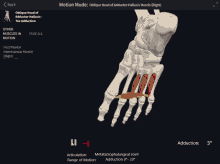 a computer screen shows a skeleton of a foot with muscles in motion