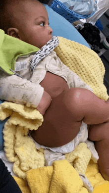 a baby in a diaper is laying on a yellow blanket and looking at the camera