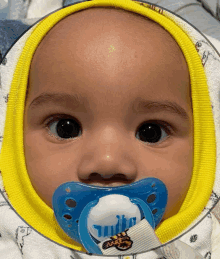 a baby with a pacifier in his mouth is wearing a yellow and white hoodie