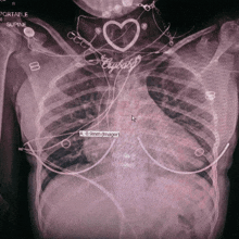 an x-ray of a woman 's chest shows a heart shaped necklace with the word crybaby on it