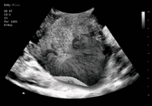 a black and white ultrasound image of a cat with the words baby miao at the bottom