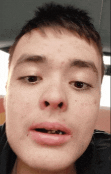 a close up of a young man 's face with a tooth missing