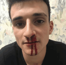 a man with a bloody nose and mouth looks at the camera