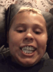 a young boy with braces on his teeth is smiling while laying on a couch .