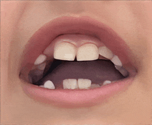 a close up of a person 's mouth with their teeth showing