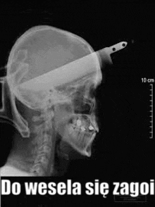 a black and white x-ray of a man 's head with a knife sticking out of it .