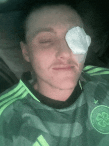 a man with a bandage on his eye wears a green celtic shirt