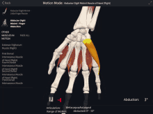 a skeleton of a hand is shown on a screen that says abductor digiti minimi muscle of hand