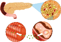 an illustration of a pancreas muscle fiber and fat