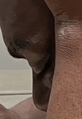 a close up of a person 's leg with a slight bump on it