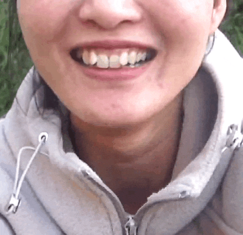 a close up of a woman 's mouth and teeth with a grey jacket on