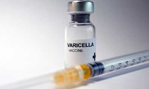 Varicella Vaccine