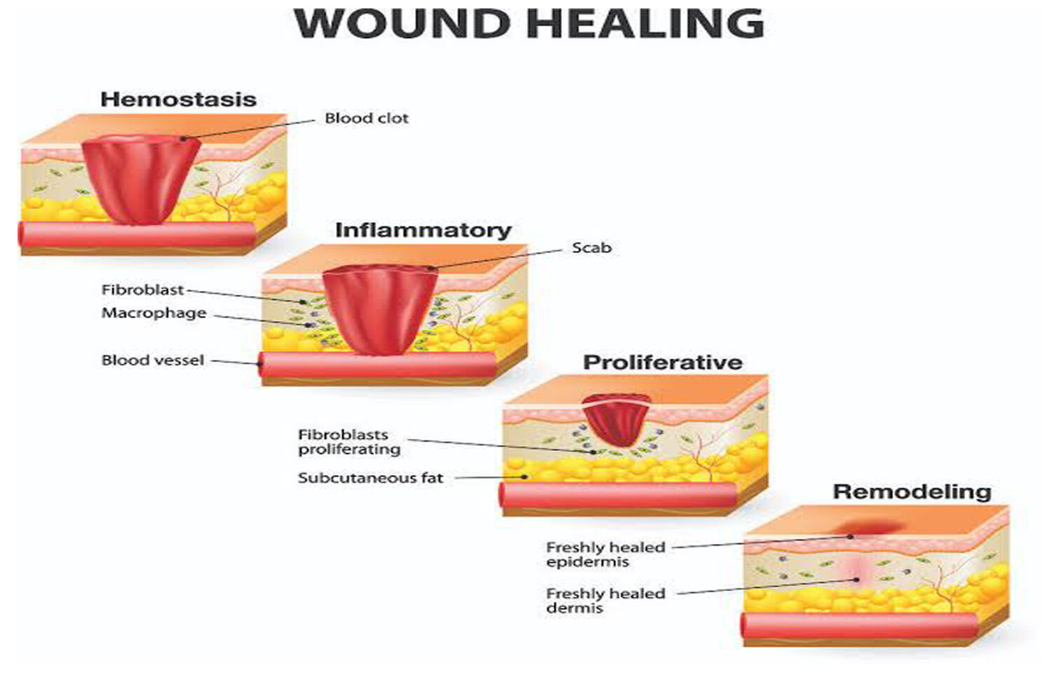 Stages And Process Of Wound Healing Medchrometube Bes - vrogue.co