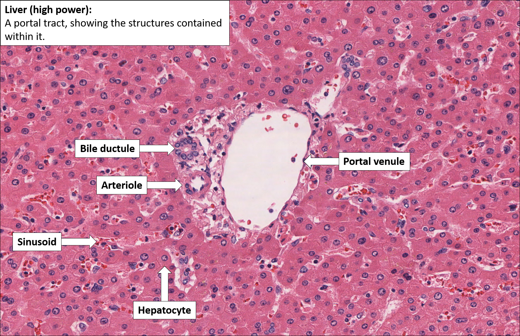 Liver Normal Histology Nus Pathweb Nus Pathweb | Free Nude Porn Photos