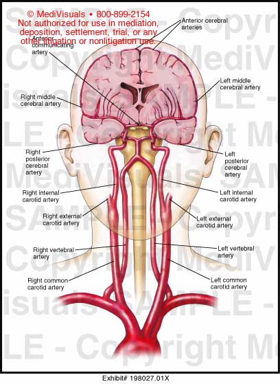 Blood Supply to the Brain Medical Illustration Medivisuals