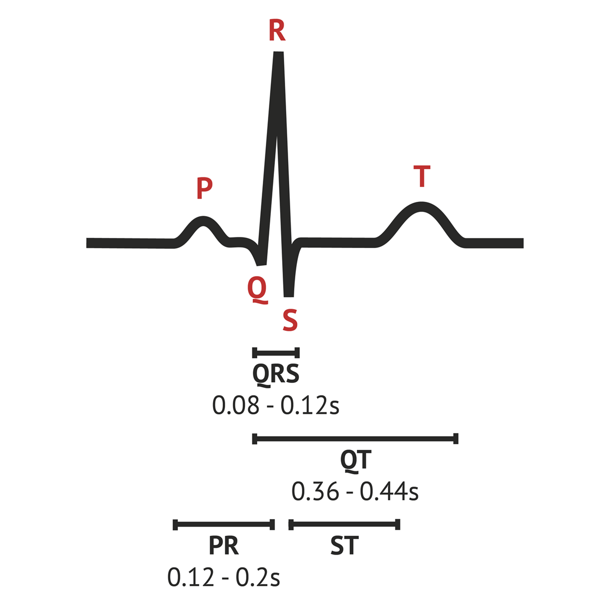 Normal Ecg Tracing