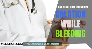 When is the Best Time of the Month for Endometrial Ablation While Bleeding?