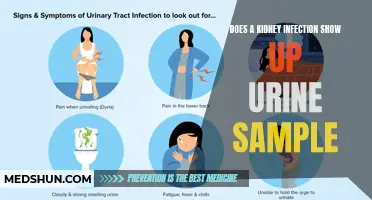 Urine Test: Detecting Kidney Infections