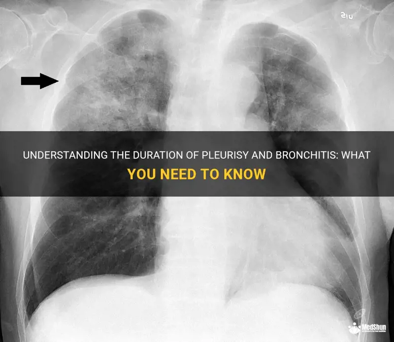 Understanding The Duration Of Pleurisy And Bronchitis: What You Need To ...