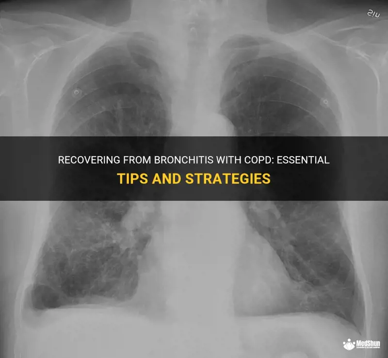 Recovering From Bronchitis With Copd: Essential Tips And Strategies ...