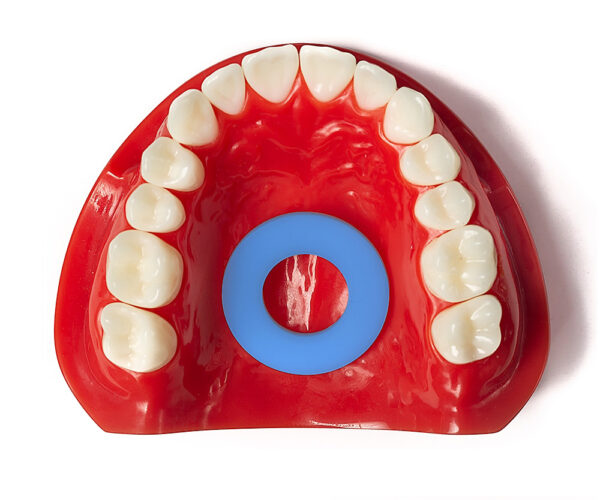 mewing appliance in dental model