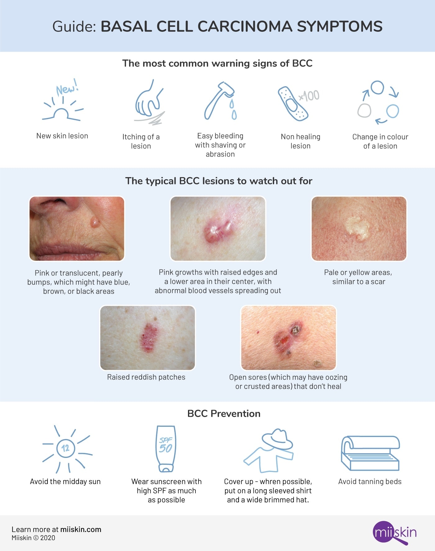 Skin Cancer Types Basal Cell Carcinoma (BCC) Squamous Cell Carcinoma ...