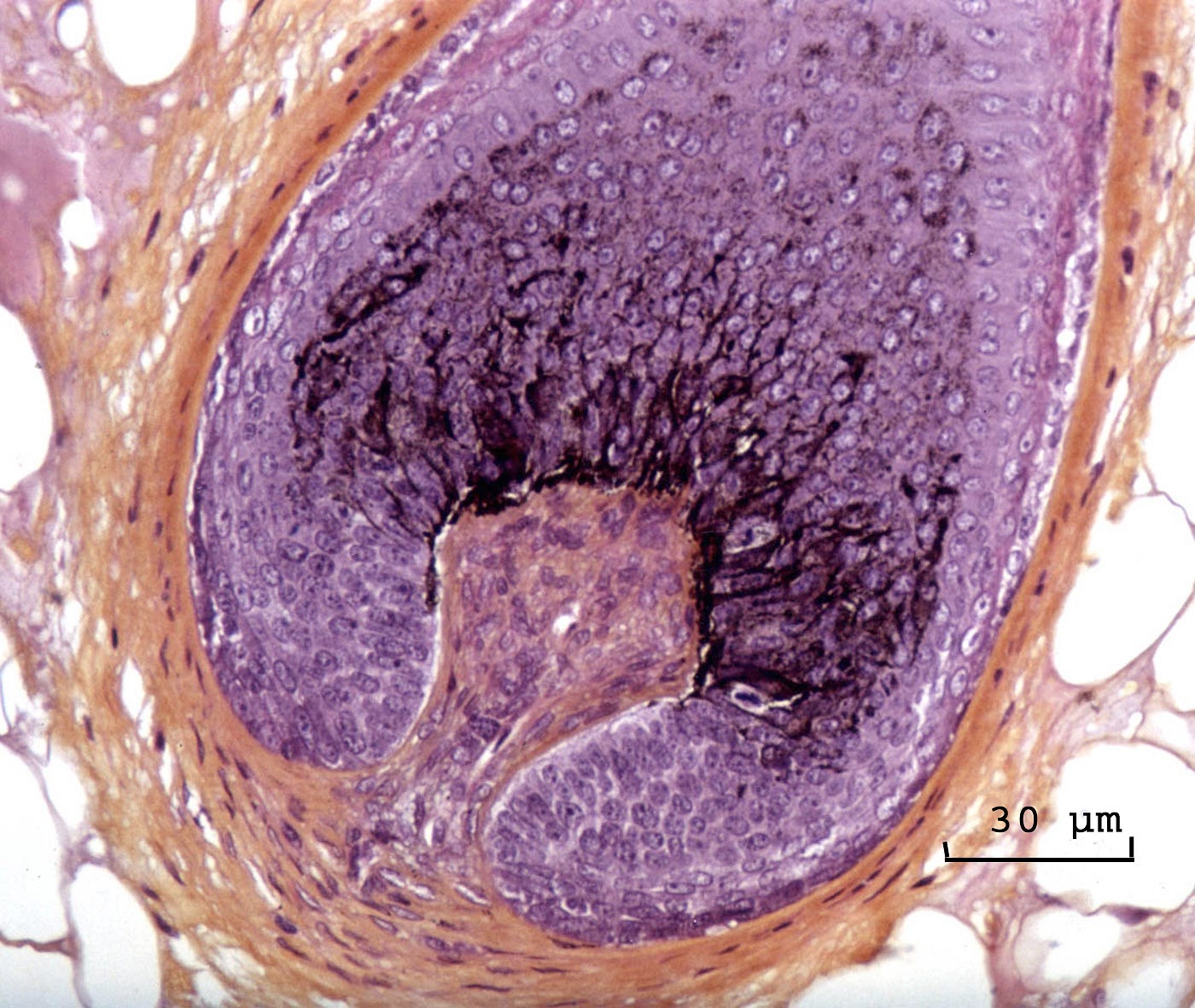 Dermal Papilla Histology