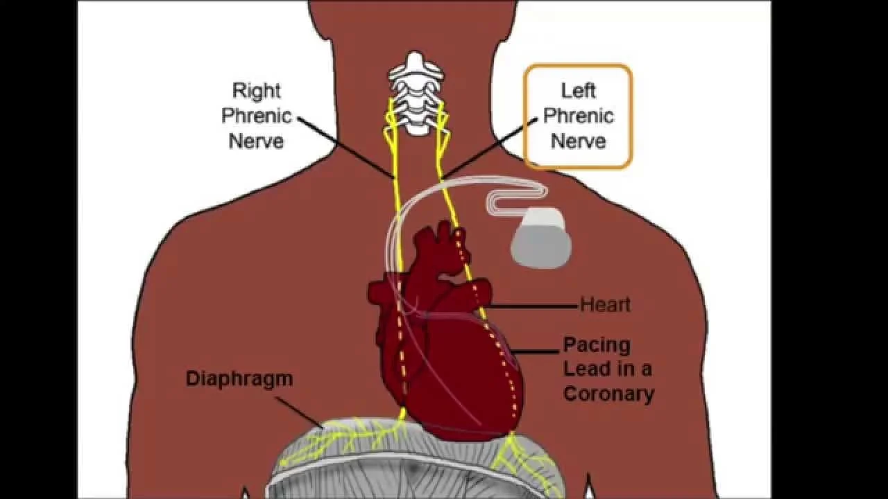 Phrenic Nerve - Anatomy, Origin, Course, Structure