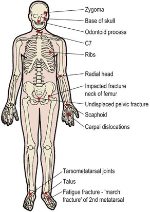 The principles of managing trauma | Musculoskeletal Key