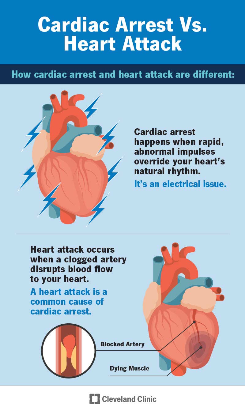 Cardiac Arrest Treatment