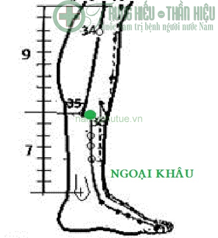 Huyệt ngoại khâu