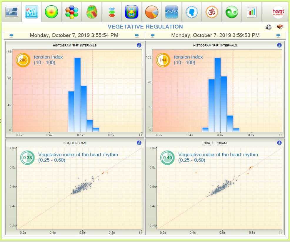 emf-shield-natures-frequencies-heart-rate-variable-testing-2