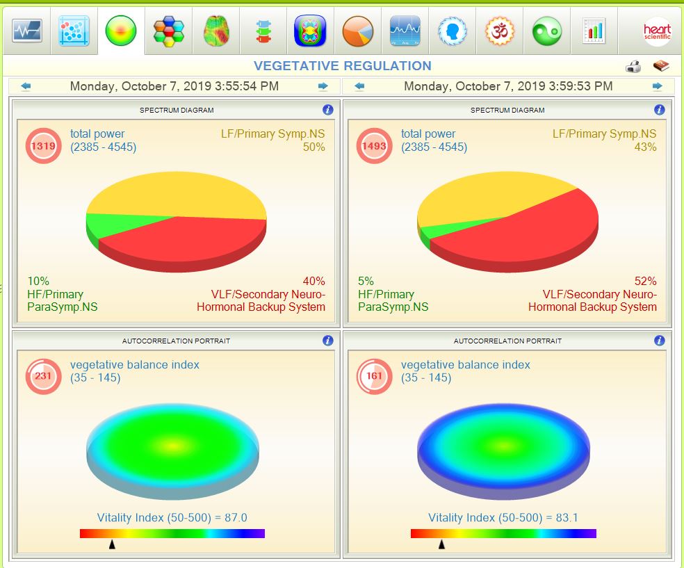 emf-shield-natures-frequencies-heart-rate-variable-testing-3