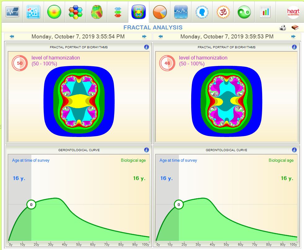 emf-shield-natures-frequencies-heart-rate-variable-testing-7