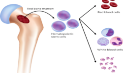 Hematopoiesis