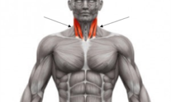 Sternocleidomastoid