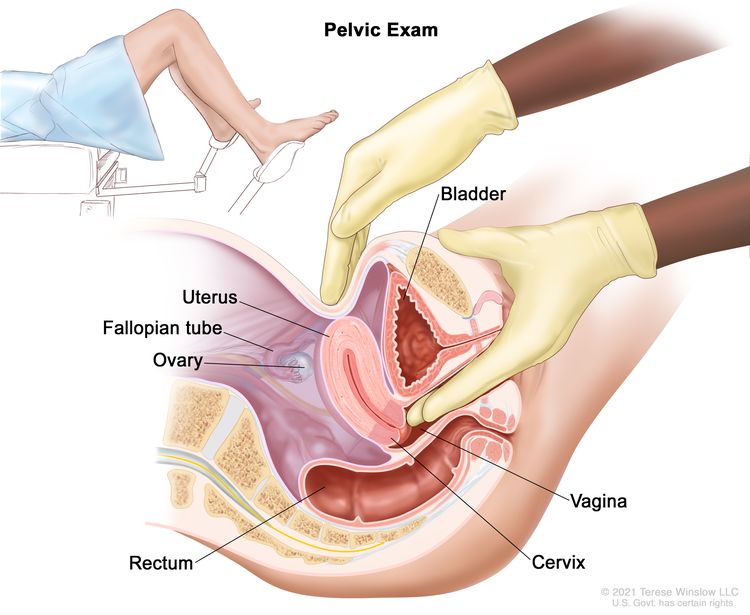 Pelvic exam; drawing shows a side view of the female reproductive anatomy during a pelvic exam. The uterus, left fallopian tube, left ovary, cervix, vagina, bladder, and rectum are shown. Two gloved fingers of one hand of the doctor or nurse are shown inserted into the vagina, while the other hand is shown pressing on the lower abdomen. The inset shows a woman covered by a drape on an exam table with her legs apart and her feet in stirrups.