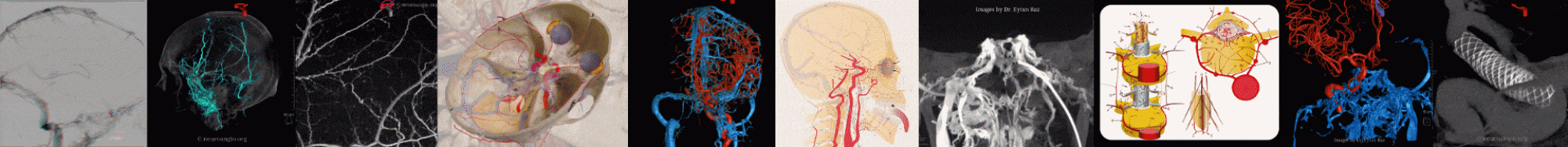 neuroangio.org