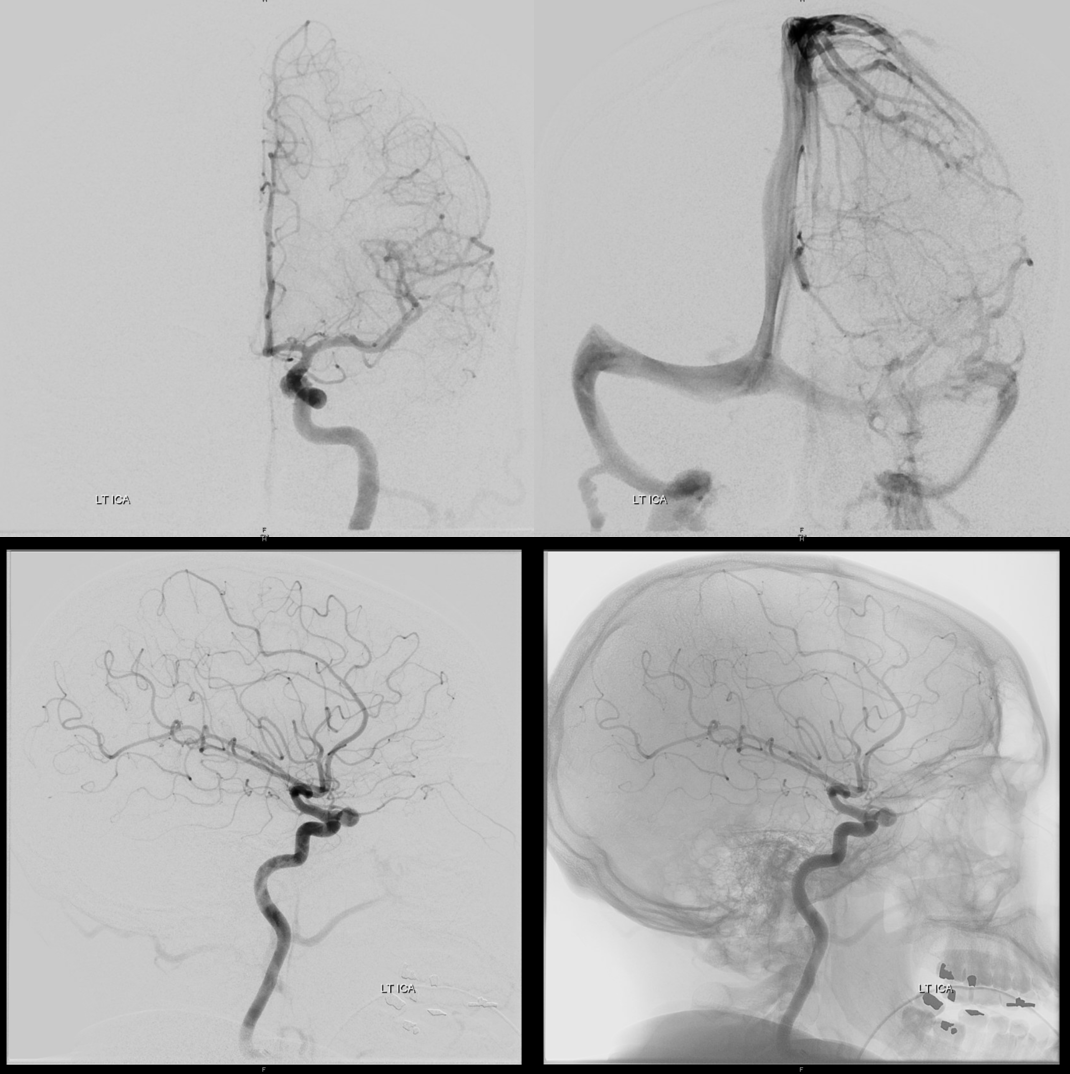 Index of /wp-content/uploads/Archives/Trauma/Carotid-cave ...