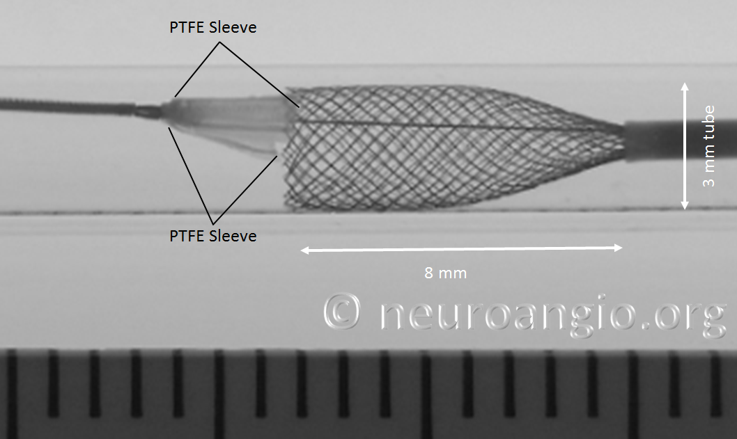 https://neuroangio.org/wp-content/uploads/PED/PED_Flex_Delivery_Tube_4.png